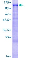GAA / Alpha-Glucosidase, Acid Protein - 12.5% SDS-PAGE of human GAA stained with Coomassie Blue