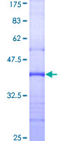 GAA / Alpha-Glucosidase, Acid Protein - 12.5% SDS-PAGE Stained with Coomassie Blue.