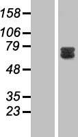 GAB2 Protein - Western validation with an anti-DDK antibody * L: Control HEK293 lysate R: Over-expression lysate