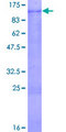 GAB2 Protein - 12.5% SDS-PAGE of human GAB2 stained with Coomassie Blue