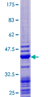 GABARAP Protein - 12.5% SDS-PAGE of human GABARAP stained with Coomassie Blue