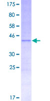 GABARAP Protein - 12.5% SDS-PAGE Stained with Coomassie Blue.