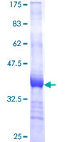 GABARAPL2 / ATG8 Protein - 12.5% SDS-PAGE Stained with Coomassie Blue.