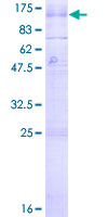 GABBR1 / GABA B Receptor 1 Protein - 12.5% SDS-PAGE of human GABBR1 stained with Coomassie Blue