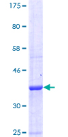 GABBR1 / GABA B Receptor 1 Protein - 12.5% SDS-PAGE Stained with Coomassie Blue.
