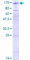 GABBR2 / GABA B Receptor 2 Protein - 12.5% SDS-PAGE of human GABBR2 stained with Coomassie Blue