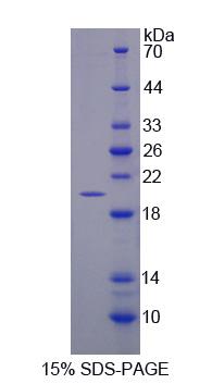 GABPA / NRF2 Protein - Recombinant  GA Binding Protein Transcription Factor Alpha By SDS-PAGE