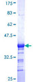 GABPB1 Protein - 12.5% SDS-PAGE Stained with Coomassie Blue.