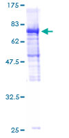 GABPB2 Protein - 12.5% SDS-PAGE of human MGC29891 stained with Coomassie Blue