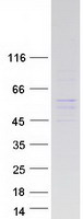 GABPB2 Protein - Purified recombinant protein GABPB2 was analyzed by SDS-PAGE gel and Coomassie Blue Staining