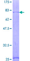 GABRA1 Protein - 12.5% SDS-PAGE of human GABRA1 stained with Coomassie Blue