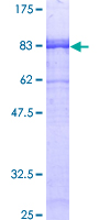 GABRA3 Protein - 12.5% SDS-PAGE of human GABRA3 stained with Coomassie Blue
