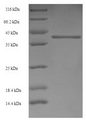 GABRA4 Protein - (Tris-Glycine gel) Discontinuous SDS-PAGE (reduced) with 5% enrichment gel and 15% separation gel.