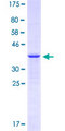 GABRA4 Protein - 12.5% SDS-PAGE Stained with Coomassie Blue.