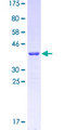 GABRA6 Protein - 12.5% SDS-PAGE Stained with Coomassie Blue.