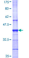 GABRB1 Protein - 12.5% SDS-PAGE Stained with Coomassie Blue.