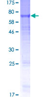 GABRB2 Protein - 12.5% SDS-PAGE of human GABRB2 stained with Coomassie Blue