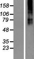 GABRB3 Protein - Western validation with an anti-DDK antibody * L: Control HEK293 lysate R: Over-expression lysate