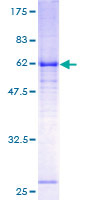 GABRE Protein - 12.5% SDS-PAGE of human GABRE stained with Coomassie Blue