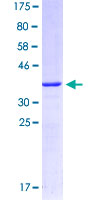GABRE Protein - 12.5% SDS-PAGE Stained with Coomassie Blue.