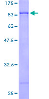 GAD1 / GAD67 Protein - 12.5% SDS-PAGE of human GAD1 stained with Coomassie Blue