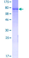 GAD65 Protein - 12.5% SDS-PAGE of human GAD2 stained with Coomassie Blue