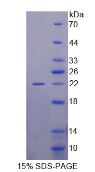 GAD65 Protein - Recombinant Glutamate Decarboxylase 2, Acid (GAD2) by SDS-PAGE