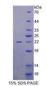GAD65 Protein - Recombinant Glutamate Decarboxylase 2, Acid (GAD2) by SDS-PAGE