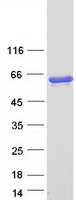 GAD65 Protein - Purified recombinant protein GAD2 was analyzed by SDS-PAGE gel and Coomassie Blue Staining