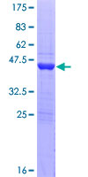GADD45A / GADD45 Protein - 12.5% SDS-PAGE of human GADD45A stained with Coomassie Blue