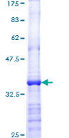 GADD45A / GADD45 Protein - 12.5% SDS-PAGE Stained with Coomassie Blue.