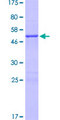 GADD45GIP1 / CRIF1 Protein - 12.5% SDS-PAGE of human GADD45GIP1 stained with Coomassie Blue