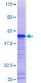 GAGE1 Protein - 12.5% SDS-PAGE of human GAGE1 stained with Coomassie Blue