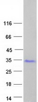GAGE2B Protein - Purified recombinant protein GAGE2B was analyzed by SDS-PAGE gel and Coomassie Blue Staining