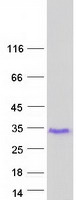 GAGE2C Protein - Purified recombinant protein GAGE2C was analyzed by SDS-PAGE gel and Coomassie Blue Staining