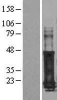 GAGE7 Protein - Western validation with an anti-DDK antibody * L: Control HEK293 lysate R: Over-expression lysate