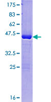 GAGEC1 / JM27 Protein - 12.5% SDS-PAGE of human PAGE4 stained with Coomassie Blue