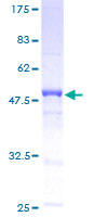 GAJ / MND1 Protein - 12.5% SDS-PAGE of human GAJ stained with Coomassie Blue