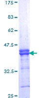 GAK Protein - 12.5% SDS-PAGE Stained with Coomassie Blue.