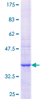 GAL3ST4 Protein - 12.5% SDS-PAGE Stained with Coomassie Blue.