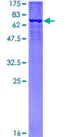 GAL4 / Galectin 4 Protein - 12.5% SDS-PAGE Stained with Coomassie Blue.