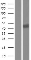 GALC / Galactocerebrosidase Protein - Western validation with an anti-DDK antibody * L: Control HEK293 lysate R: Over-expression lysate