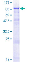 GALC / Galactocerebrosidase Protein - 12.5% SDS-PAGE of human GALC stained with Coomassie Blue