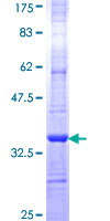 GALC / Galactocerebrosidase Protein - 12.5% SDS-PAGE Stained with Coomassie Blue.