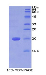 GALC / Galactocerebrosidase Protein - Recombinant Galactosylceramidase By SDS-PAGE