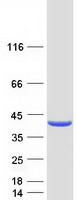 GALE / UDP-Glucose 4-Epimerase Protein - Purified recombinant protein GALE was analyzed by SDS-PAGE gel and Coomassie Blue Staining