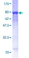 GALK2 Protein - 12.5% SDS-PAGE of human GALK2 stained with Coomassie Blue