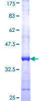 GALK2 Protein - 12.5% SDS-PAGE Stained with Coomassie Blue.