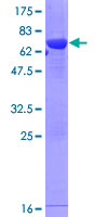 GALM / Mutarotase Protein - 12.5% SDS-PAGE of human GALM stained with Coomassie Blue