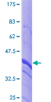 GALNS / Chondroitinase Protein - 12.5% SDS-PAGE Stained with Coomassie Blue.